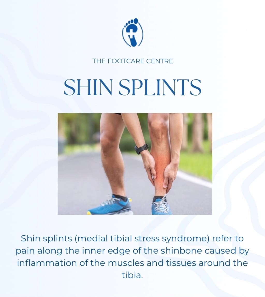 Shin Splints